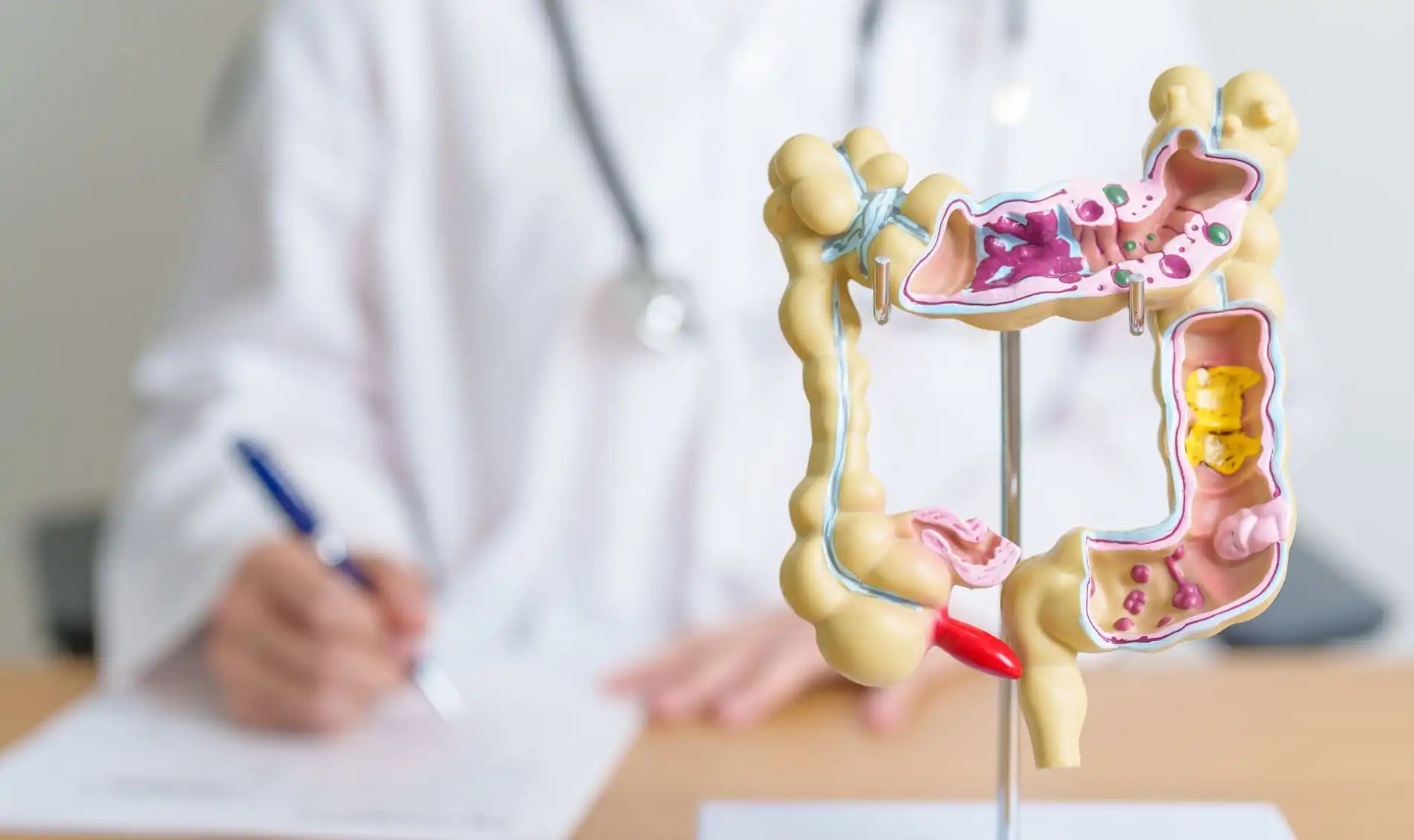 Understanding Colorectal Health: Prevention, Screening, and Treatment Options